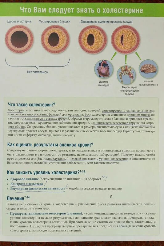 Симптомы повышенного холестерина. Высокий холестерине глаза. Признаки высокого холестерина в глазах. Как по глазам определить холестерин. Симптомы повышенного холестерина по глазам.