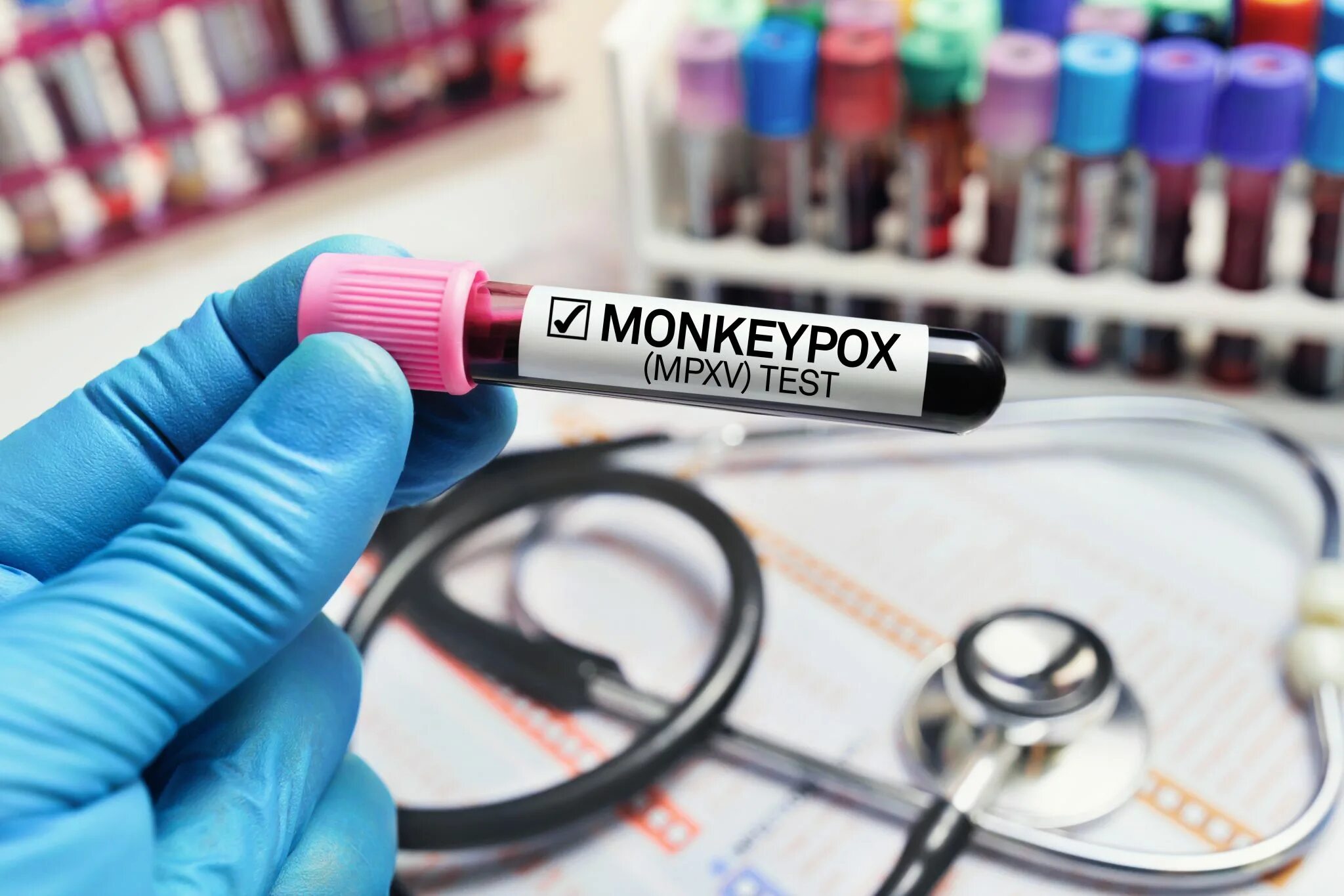 Mpox test