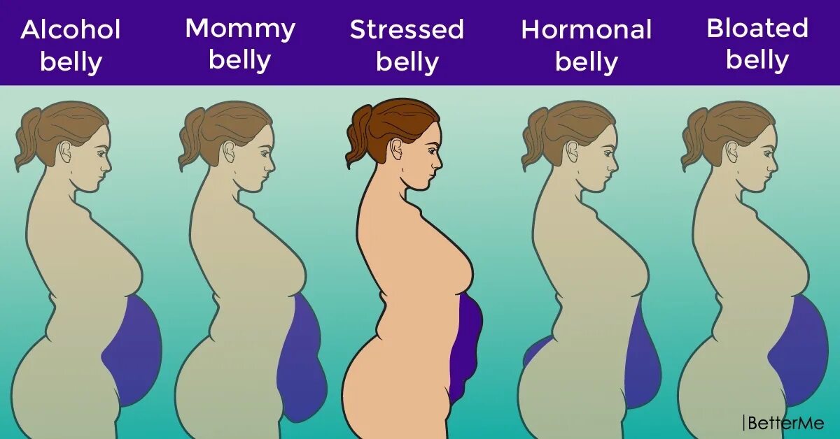 Почему в животе бывает. Виды живота у женщин. Формы женских животиков. Типы женских животиков. Типы живота у женщин гормональный.