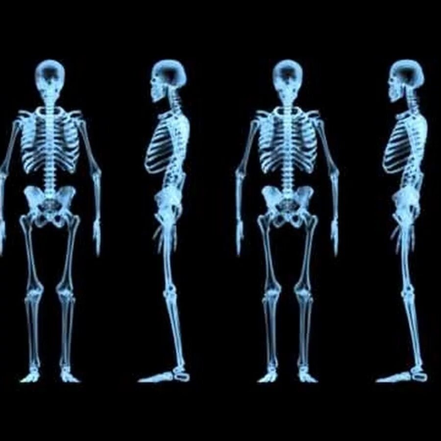 Structured body