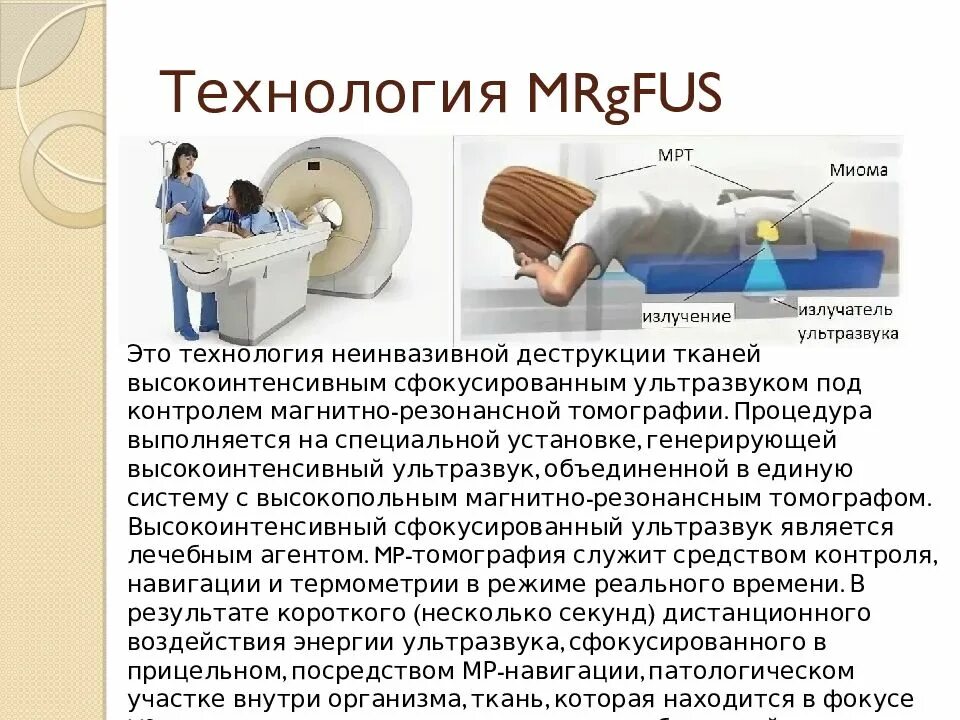 Абляция миомы. Фуз-абляция миомы матки. ультразвуковая абляция миомы.