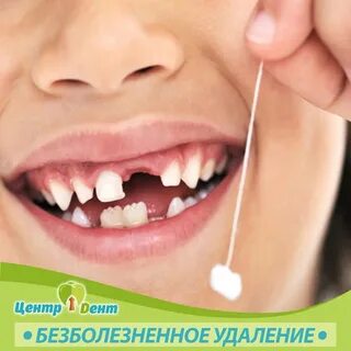 Зуб выпал остался