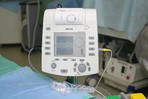 Дезартеризацию узлов