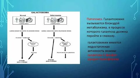 Нарушение обмена галактозы клинические рекомендации