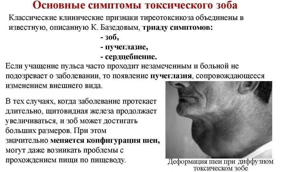 Шея симптом температура. Щитовидная железа у больных с дтз. характерные симптомы диффузного токсического зоба:. характерными клиническими признаками токсического зоба. основные клинические признаки синдрома тиреотоксикоза.