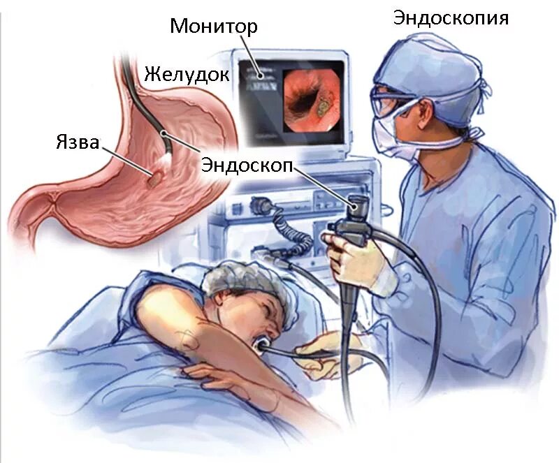Для язвенной болезни желудка характерна боль