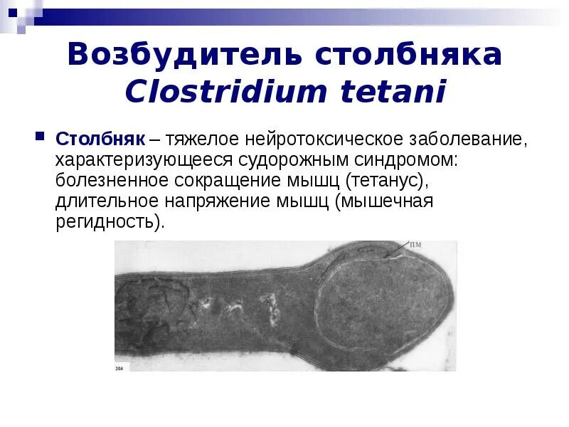 Столбняк туберкулез мозаичная болезнь табака. Clostridium tetani возбудитель. Возбудители клостридий столбняка. Острая анаэробная инфекция столбняк. Столбняк раневая инфекция.