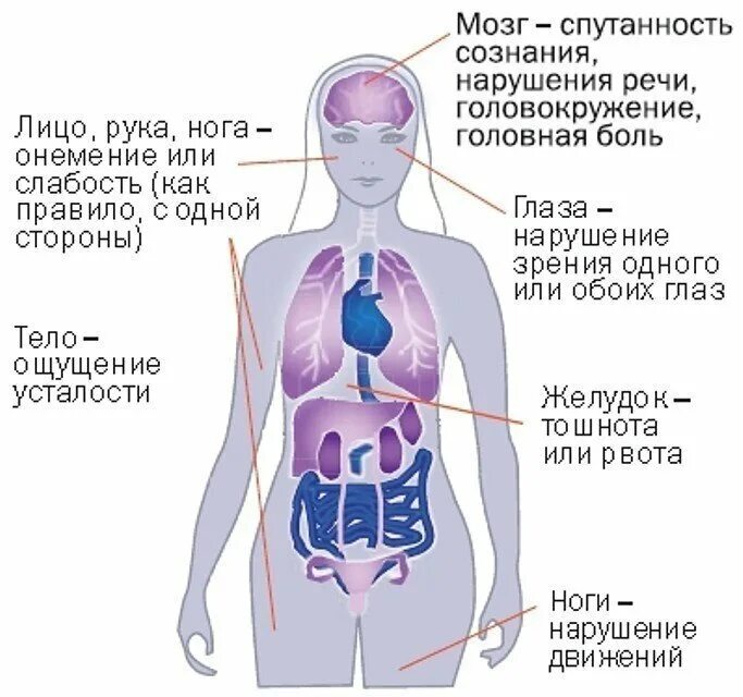 Онемевает правая сторона лица. Слабость в организме. Онемение одной половины тела. Млеет левая сторона тела. Инсульт симптомы у женщин левая сторона тела.