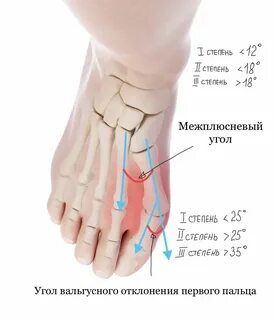 Упражнения косточки