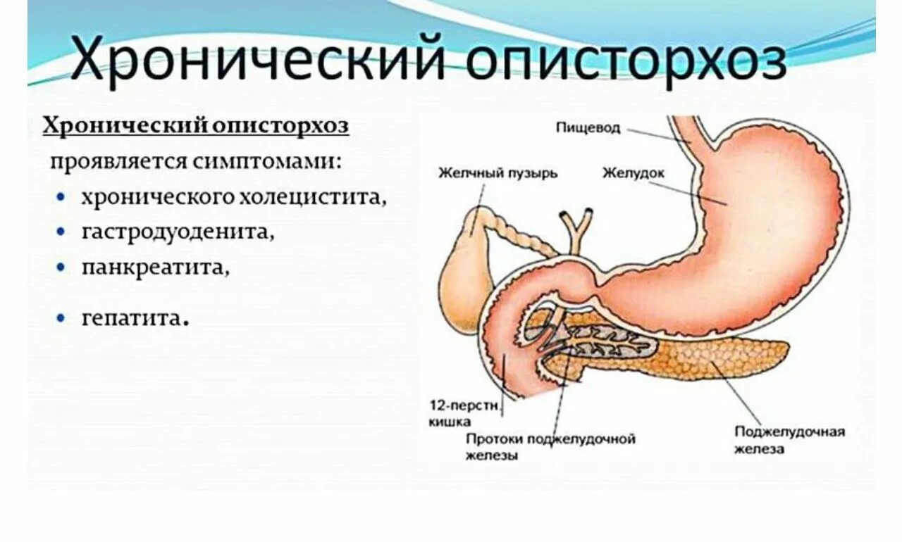 Описторхоз желчные протоки. Описторхи в печени человека симптомы. Патогенез хронического описторхоза. Хронический холецистит поджелудочной железы