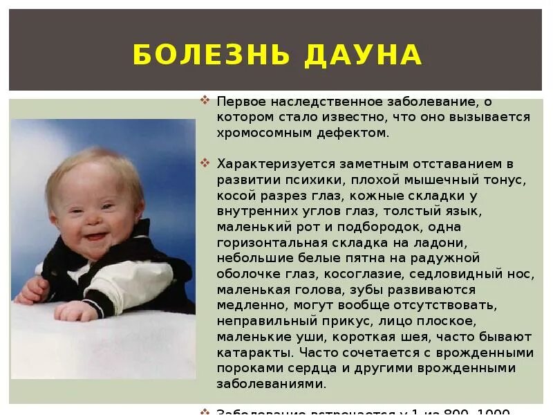 Болезнь дауна код по мкб 10. Болезнь дауна причины.