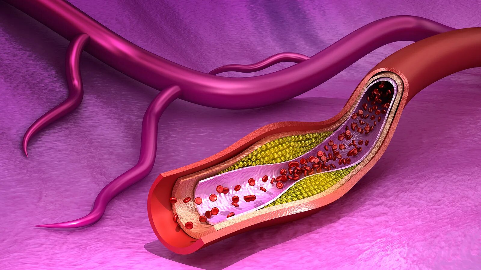 Сосуд в разрезе. Макеты по сосудам. Макет сосуда. Модель сосуды. Аорта анатомия 3d.