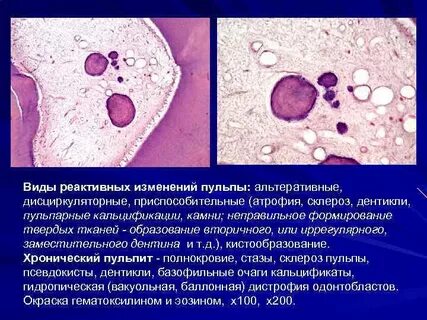 Реактивные изменения