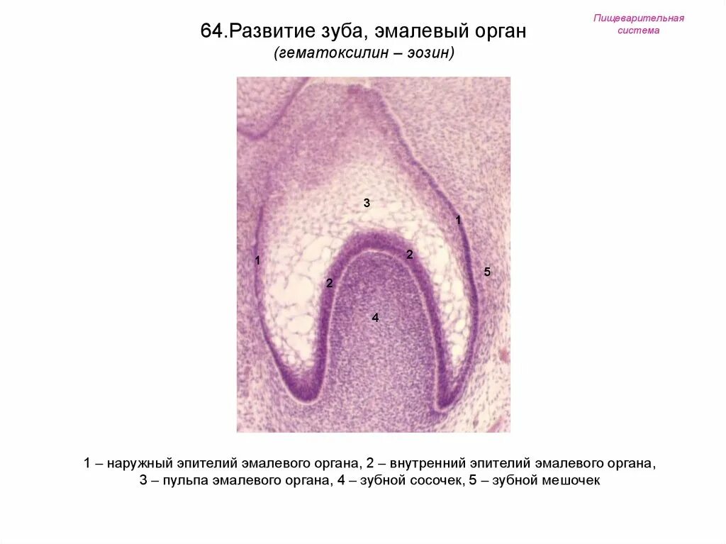 Стадии развития зуба. Ранняя стадия развития зуба гистология препарат. Развитие зуба эмалевый орган гистология. Развитие зуба эмалевый орган гистология препарат. Стадия гистогенеза зуба препарат.