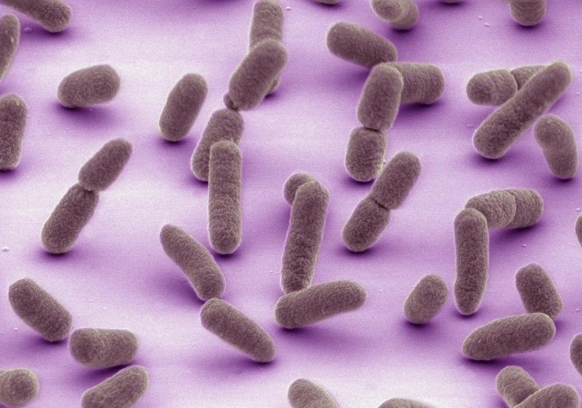 Болезнетворная бактерия палочка. Бактерия Escherichia coli. Кишечная палочка Escherichia coli. Бактерия кишечной палочки Escherichia coli. Микроорганизм,Еscherichia coli.