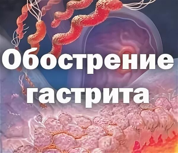 Весеннее обострение гастрита