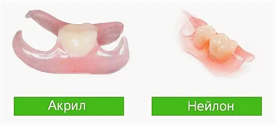 Микропротез бабочка/ иммедиат-протез. Зубной протез иммедиат бабочка. Микропротез бабочка на 1 зуб. Иммедиат протез бабочка 1 зуб.