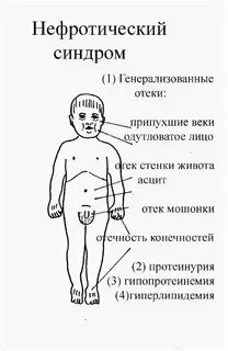 Отек тела причины