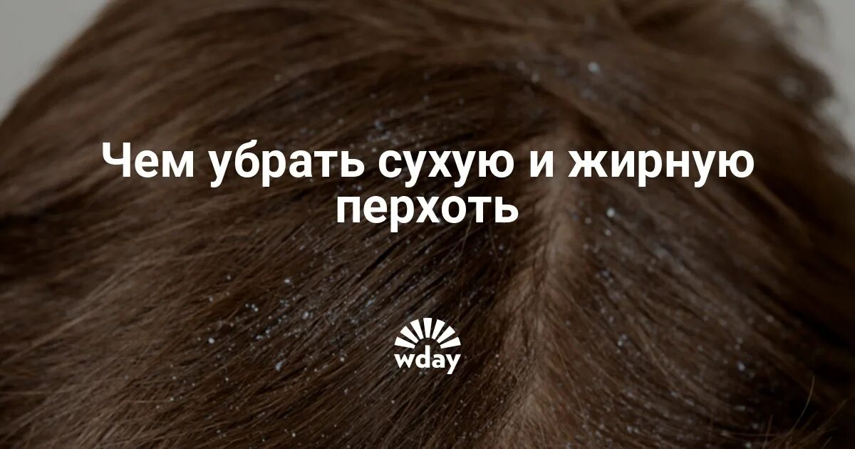 Как избавиться от перхоти быстро и эффективно