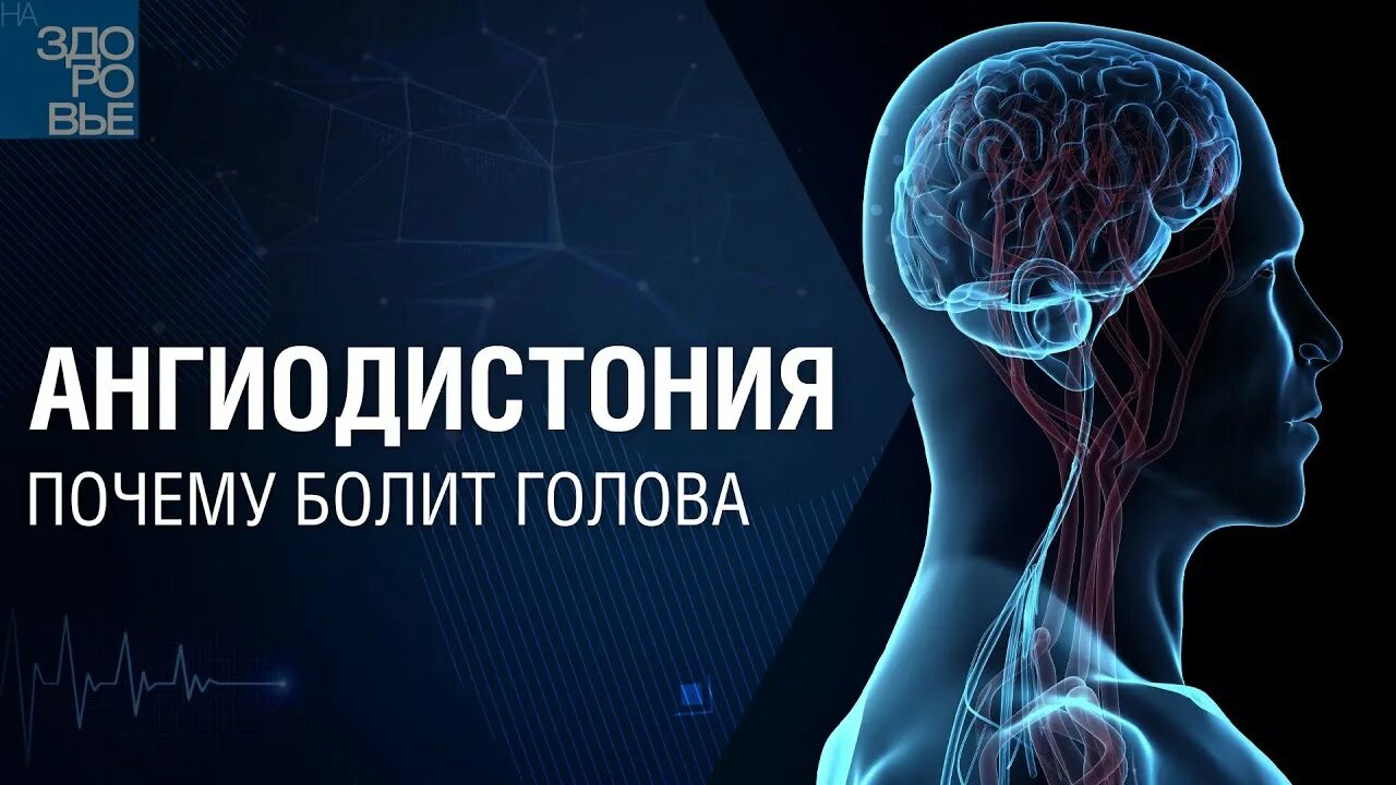 Ангиодистония сосудов. Ангиодистония сосудов головного мозга что это такое. Микроангиопатия головного мозга что это такое. Церебральная микроангиопатия мрт. Очаги микроангиопатии головного мозга что это такое.