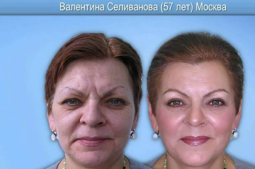 приложения для омоложения фото. приложения для омоложения фото. фильтры для селфи до и после. тусклый цвет лица. увядающая кожа лица.