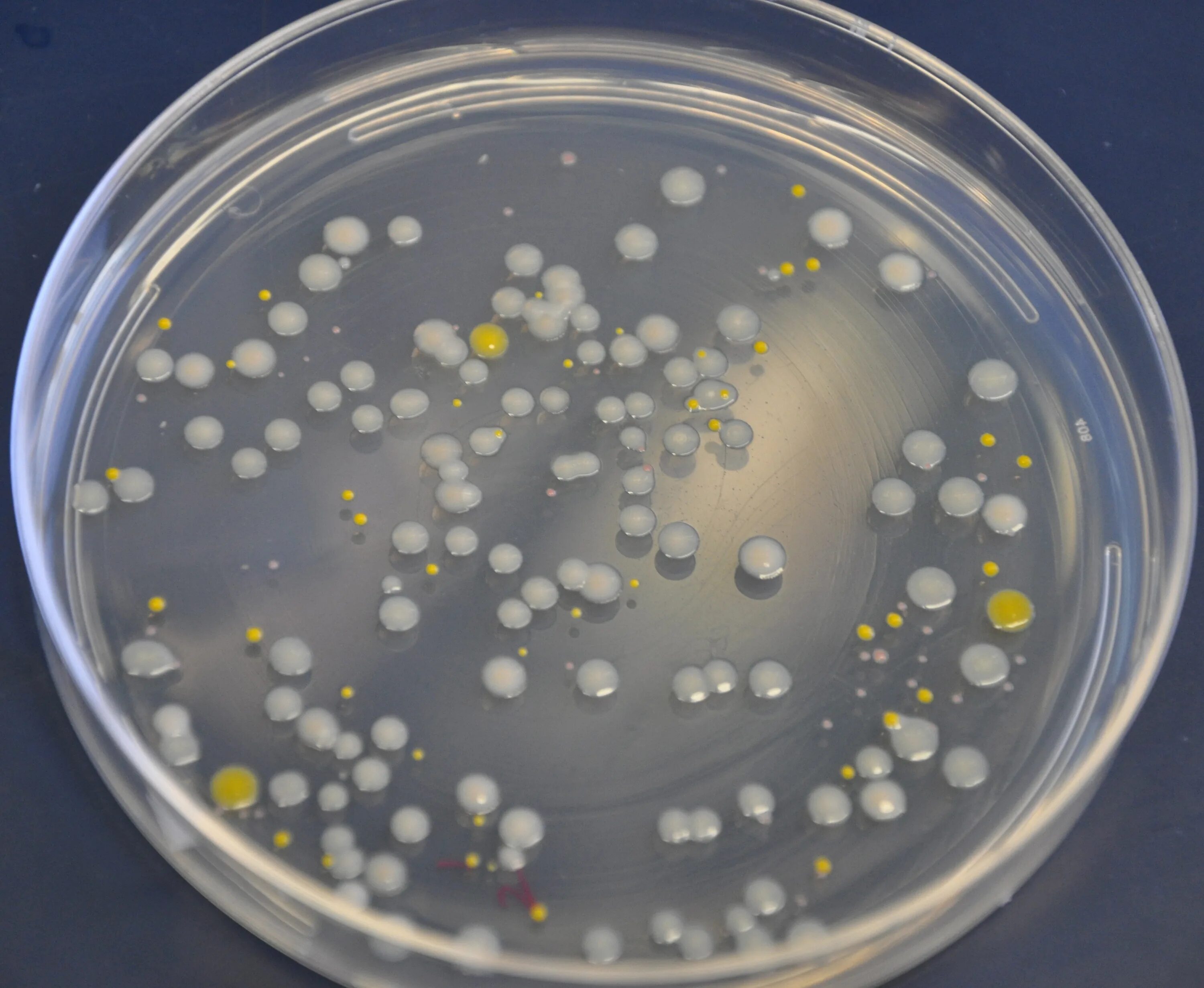 Посев staphylococcus aureus. Посев staphylococcus aureus