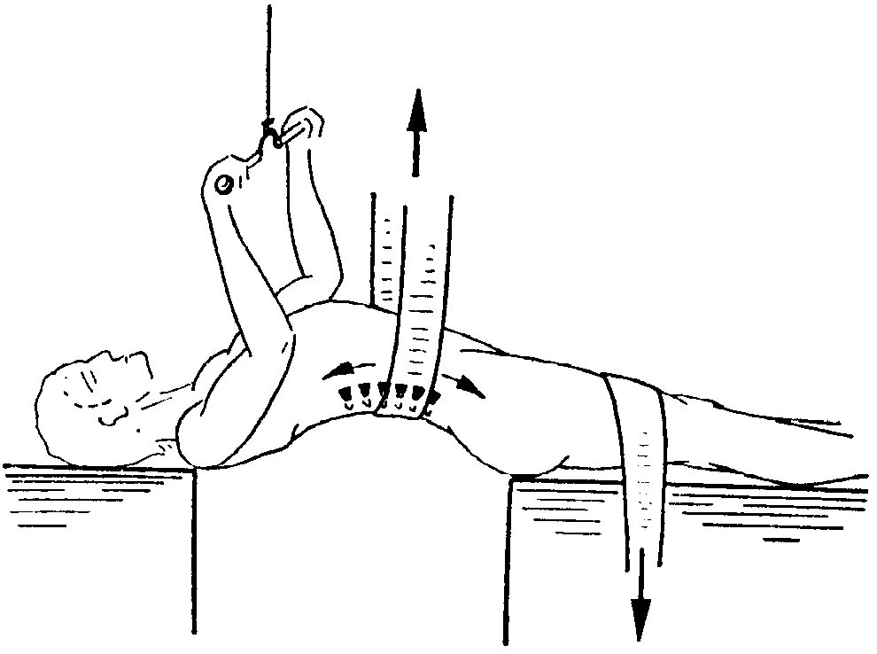 Репозиция перелома позвоночника. Методика вправления позвоночника. Вправить позвонки. Вправить поясничные позвонки. Вправление позвоночника