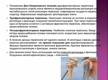 Лечение перелома без операции