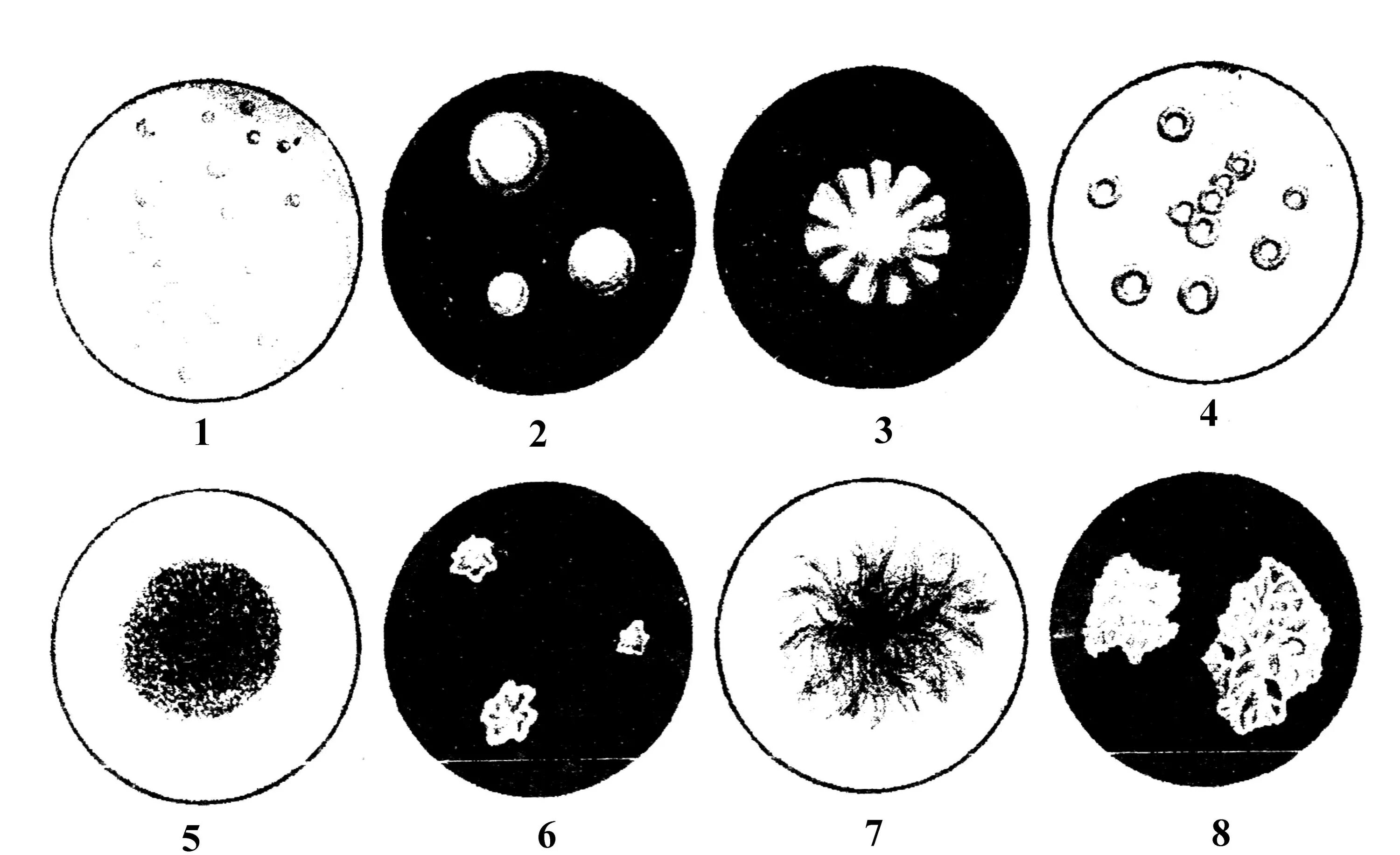 Плотные питательные среды микробиология. Структура колоний микроорганизмов. Рост колоний микробов на плотных питательных средах. Характер роста микроорганизмов на плотных питательных средах.