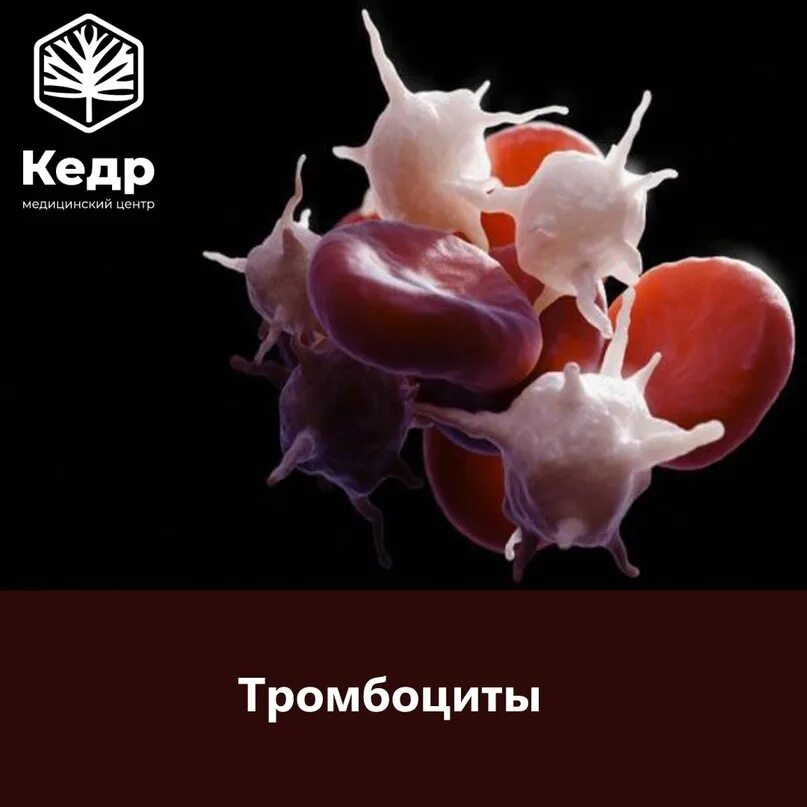 Тромбоциты 460. Эритроциты лейкоциты тромбоциты под микроскопом. Тромбоциты характеристика. Тромбоциты рисунок. Тромбоцит.