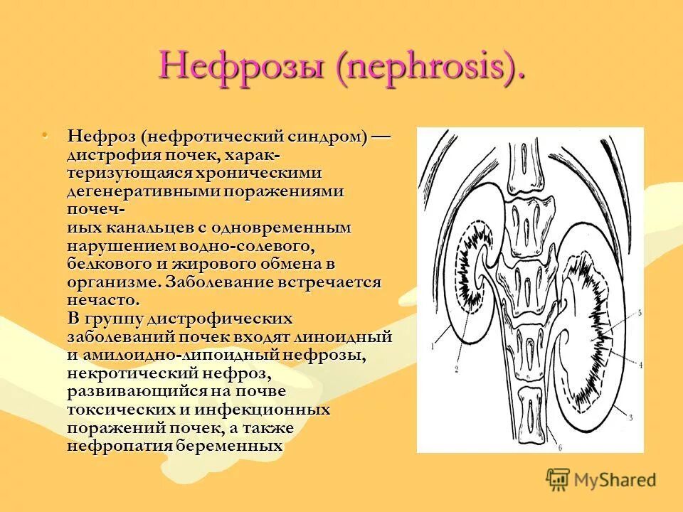 Каковы причины нарушения работы почек. Некротический нефроз почки. Патология канальцев почек.