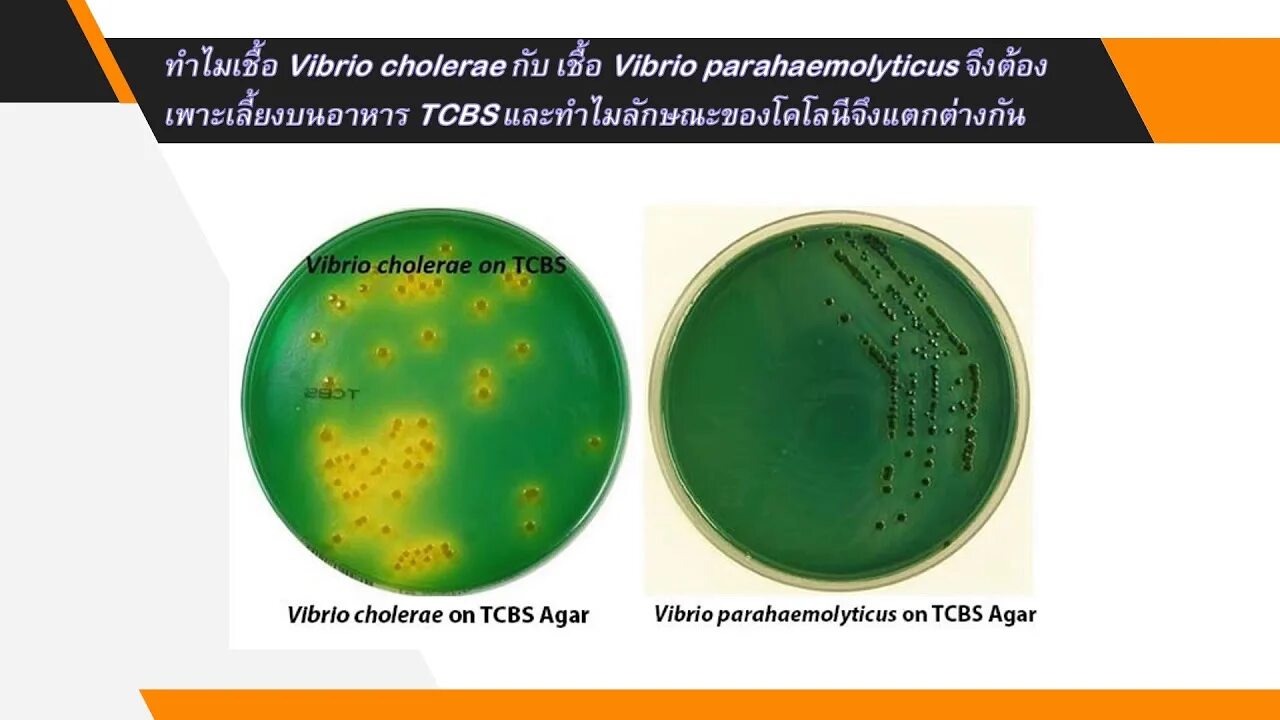 Организм трутовик окаймленный холерный вибрион. TCBS агар холерный вибрион. Холерный вибрион на щелочном агаре. Среда TCBS вибрионы. Холерный вибрион на питательных средах.