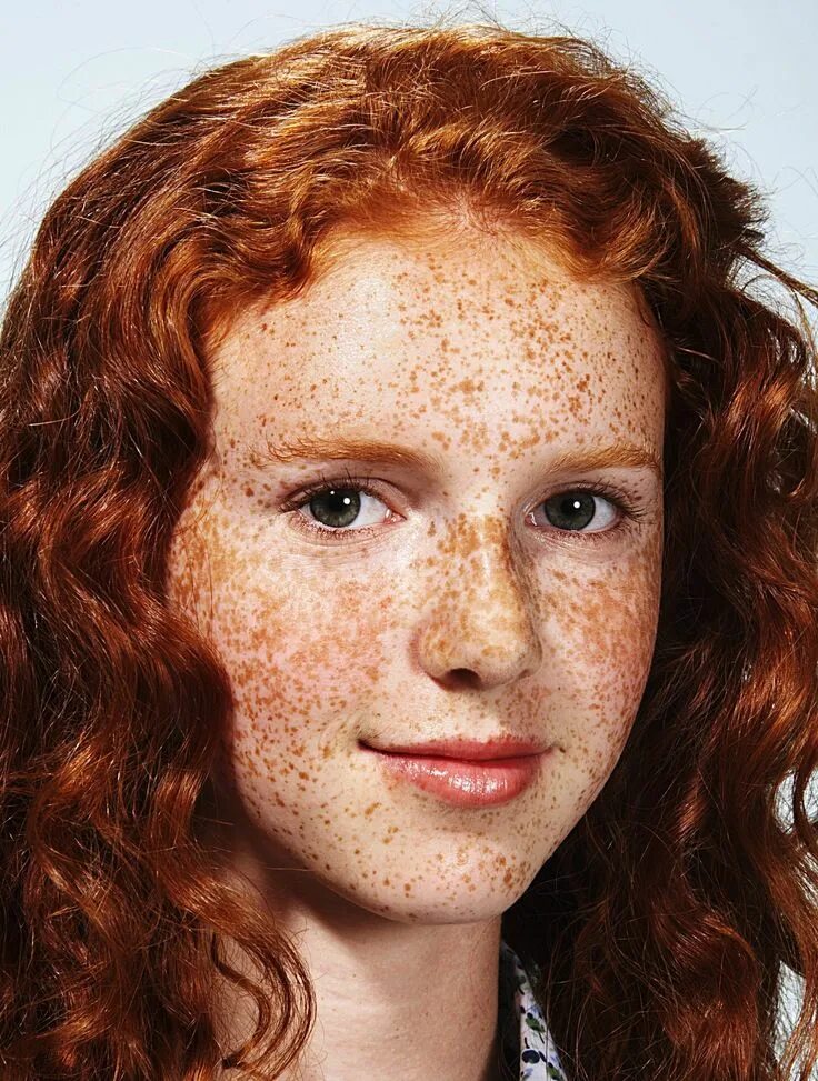 Freckles girl