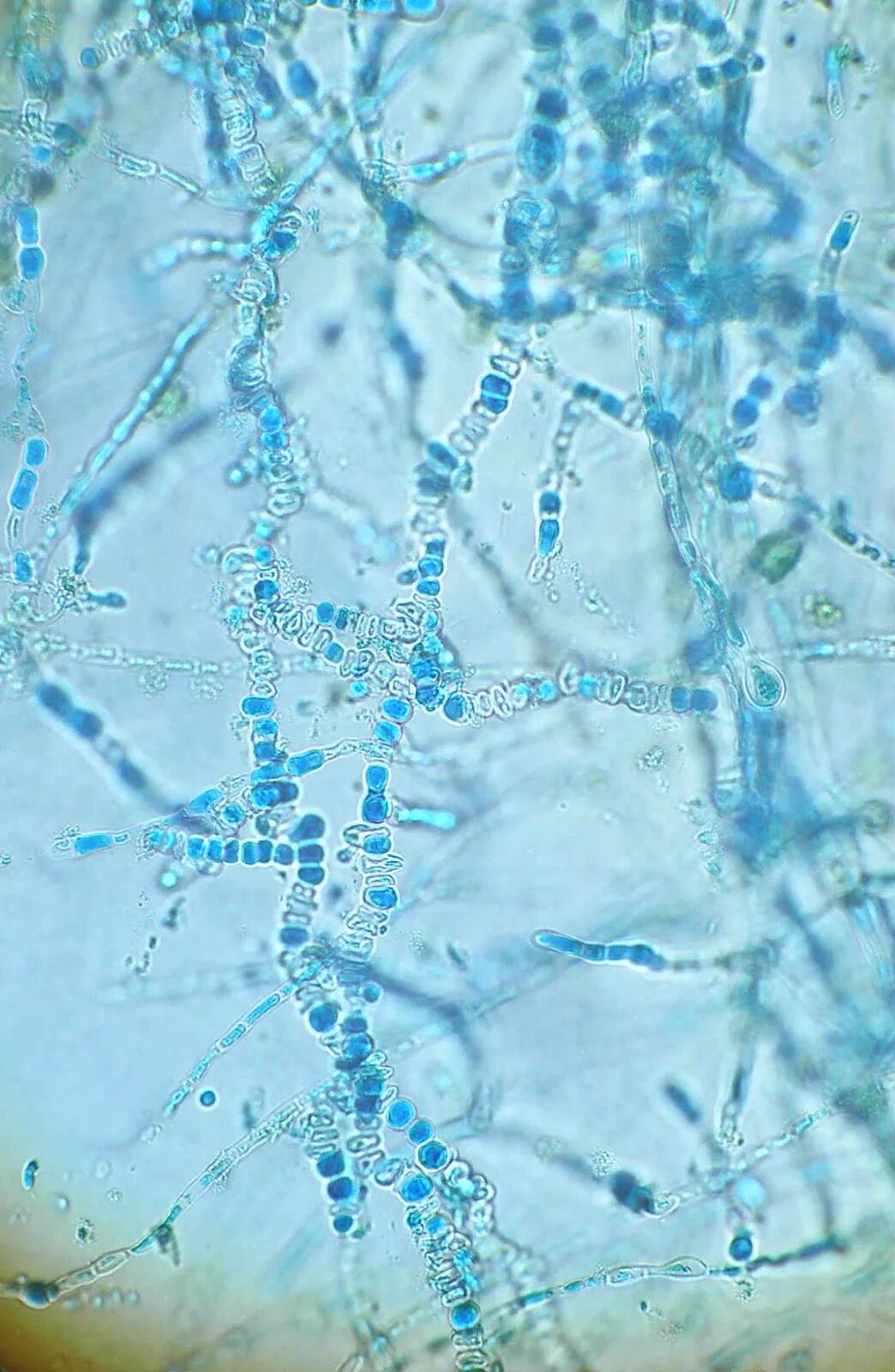 Гриб трихофитон. Грибы рода трихофитон под микроскопом. Микроскопия trichophyton verrucosum. Трихофитон ментагрофитес. Микроскопия trichophyton verrucosum.