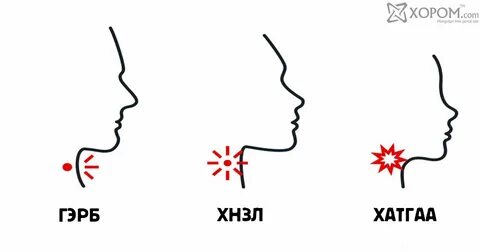 Постназальный затек у ребенка