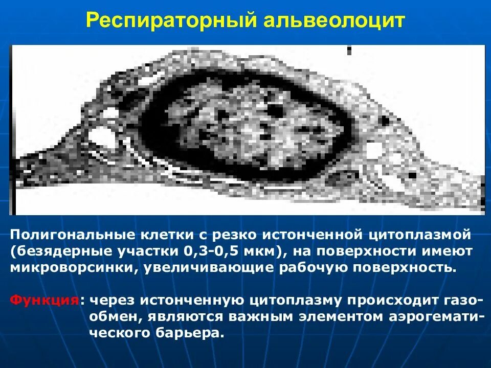 Альвеолоциты 1 2 типа строение гистология. Альвеолоциты 1 и 2 типа гистология. Альвеолоциты 1 типа строение. Пневмоцит 2 типа гистология. Электронная микрофотография.