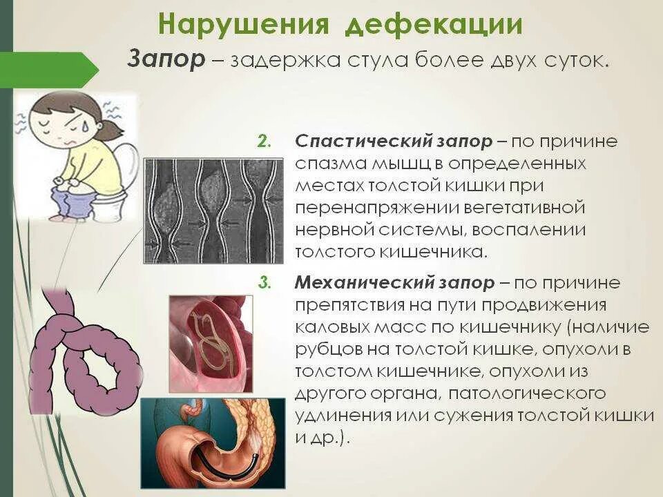 Запор 3 недели. Задержка опорожнения кишечника. Спастический запор. Причины запора.