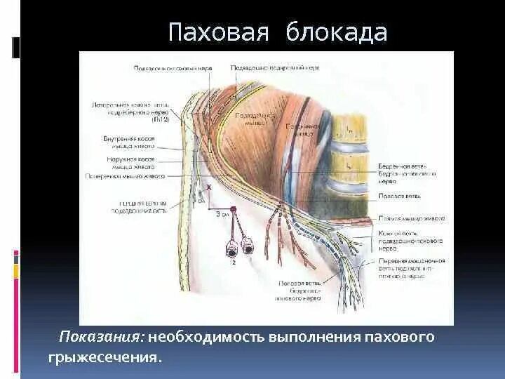 Нервная блокада. Подвздошно паховый нерв иннервация. Подвздошно паховый нерв блокада. Паховый канал и подвздошно паховый нерв. Блокада подвздошно пахового нерва.