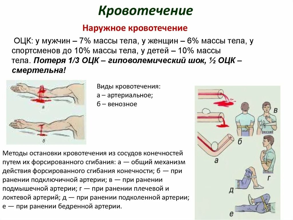 Первая помощь при наружных кровотечениях тест. Артериальное кровотечение. Схема остановки кровотечения. Методы остановки кровотечений из артерий. Кровотечение и кровопотеря.