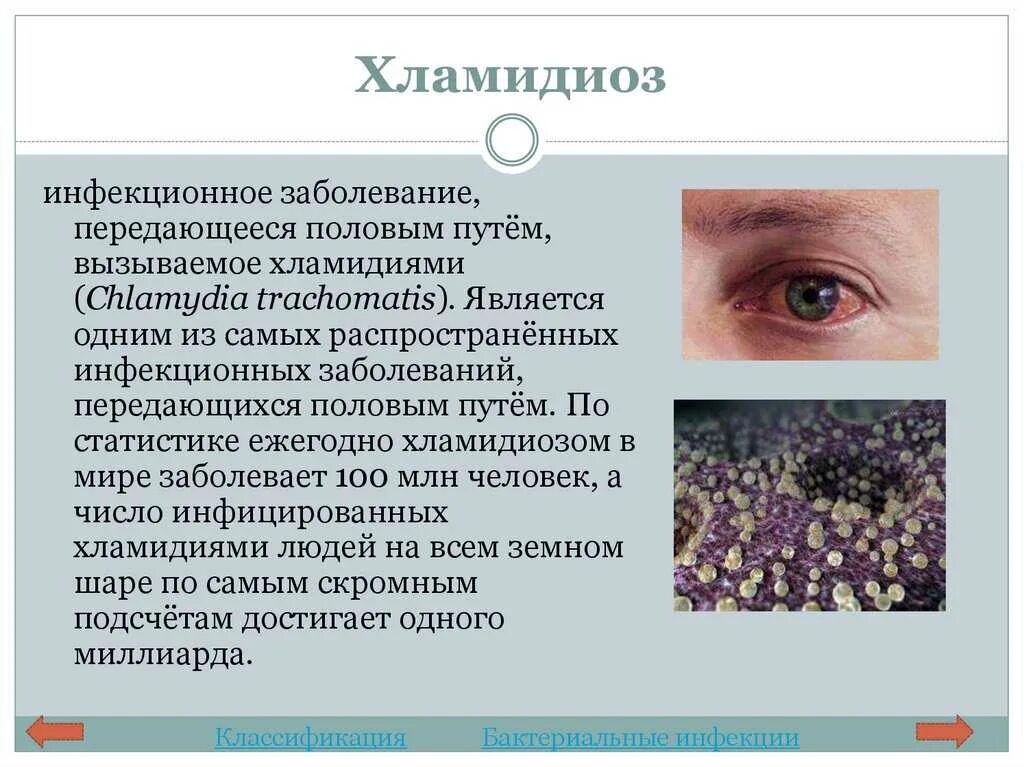 Какие существуют наиболее распространенные иппп. Хламидийные заболевания глаз. Хламидиоз клинические проявления. Кожные инфекции заболевания. Проявление заболеваний на глазах.