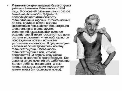 Синдром фенилкетонурия