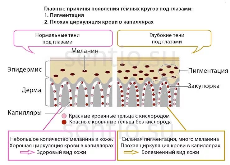 Пигмент кожи меланин находится. Причины появления темных кругов под глазами. Пигментация механизм возникновения. Причины возникновения темных кругов под глазами.