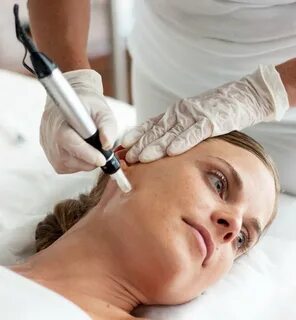Мезотерапии dermapen
