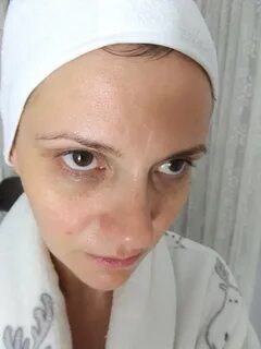 Кожа контура глаз