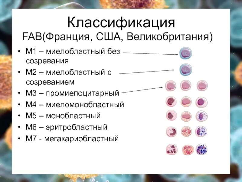 Классификация гемобластозов. Гемобластозы у детей классификация. Fab классификация гемобластозов. Гемобластозы общая характеристика.