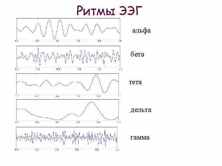Альфа ритм бета ритм тета ритм Дельта ритм ЭЭГ. Альфа и бета ритмы на ЭЭГ. ЭЭГ волны. Альфа ритм ЭЭГ.
