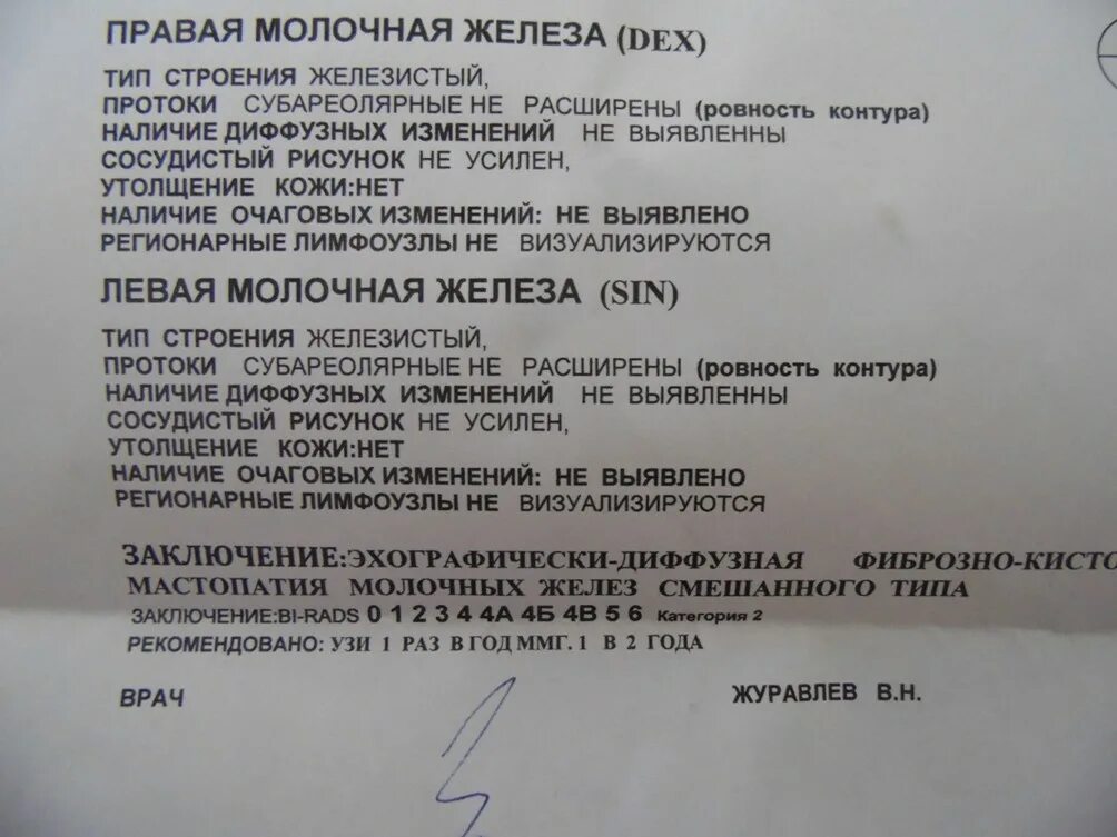 Анализ маммографии. Молочные железы на УЗИ заключение норма. УЗИ молочных желез нормальные показатели. УЗИ молочных желез норма заключение. Молочная железа УЗИ закл.