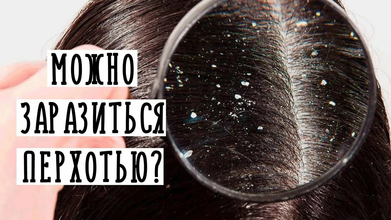 Как быстрее избавиться от перхоти. Способы избавления от перхоти. как избавиться от перхоти за 5 минут. перхоть как избавиться в домашних условиях. как избавиться от перхоти за 5 минут в домашних условиях.