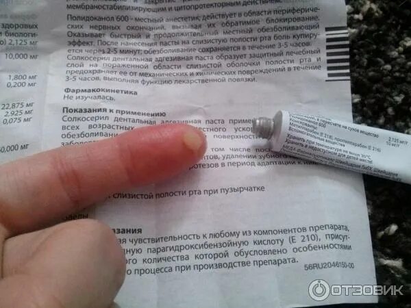 Солкосерил почему нет. Дентальная адгезивная паста. солкосерил паста. дентальная паста для заживления. как правильно наносить солкосерил дентальную пасту.