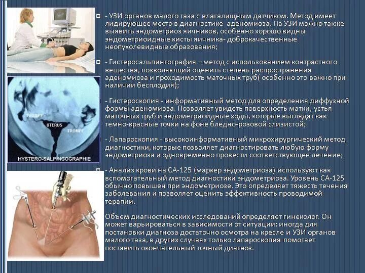 Анализы при эндометриозе. Диагностический алгоритм при эндометриозе. Эндометриоз диагности. Клинические симптомы эндометриоза. Женское заболевание эндометриоз.